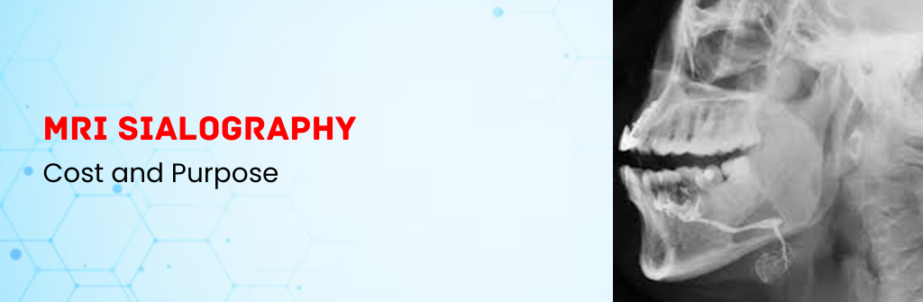  MRI Sialography Cost and Purpose